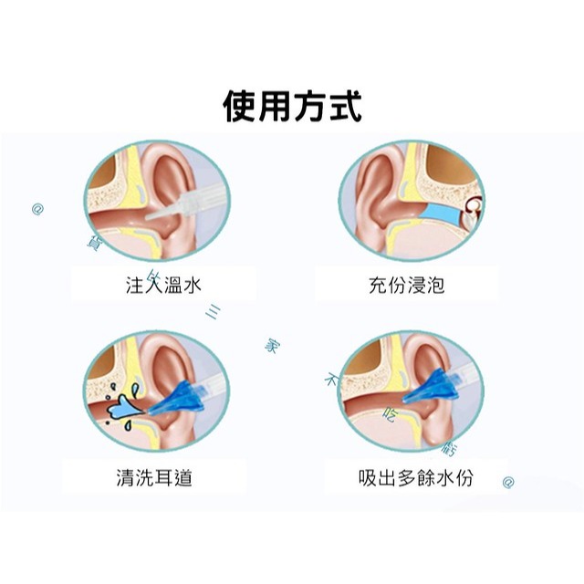 @貨比三家不吃虧@洗耳套組 洗耳器 耳屎 耳道沖洗器 采耳工具 洗耳神器 掏耳 耳扒 粘耳屎 耳結石 清潔耳垢 沖耳器-細節圖4