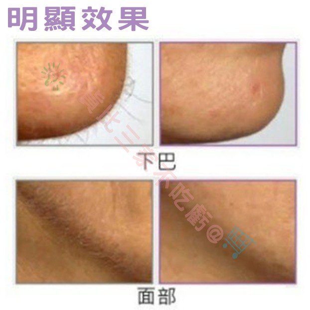 @貨比三家不吃虧@ Slique 臉部除毛器 棉線 拔毛器 脫毛夾 手動 拔毛 女人我最大 除汗毛 挽臉棒 去毛器 唇毛-細節圖6