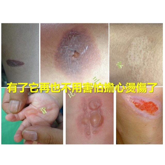 @貨比三家不吃虧@ 機車排氣管防燙蓋 護熱蓋 防燙護蓋 機車零件 排氣蓋 摩托車零件 防燙熱蓋 防燙板 保護蓋 防燙側蓋-細節圖7