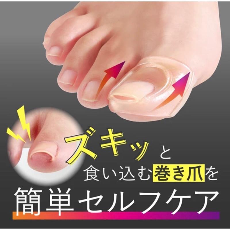 【日本製 Alphax】拇指嵌甲凝膠防護套 甲溝炎矯正器 腳趾甲矯正工具 柔軟凝膠 護理腳指甲-細節圖2