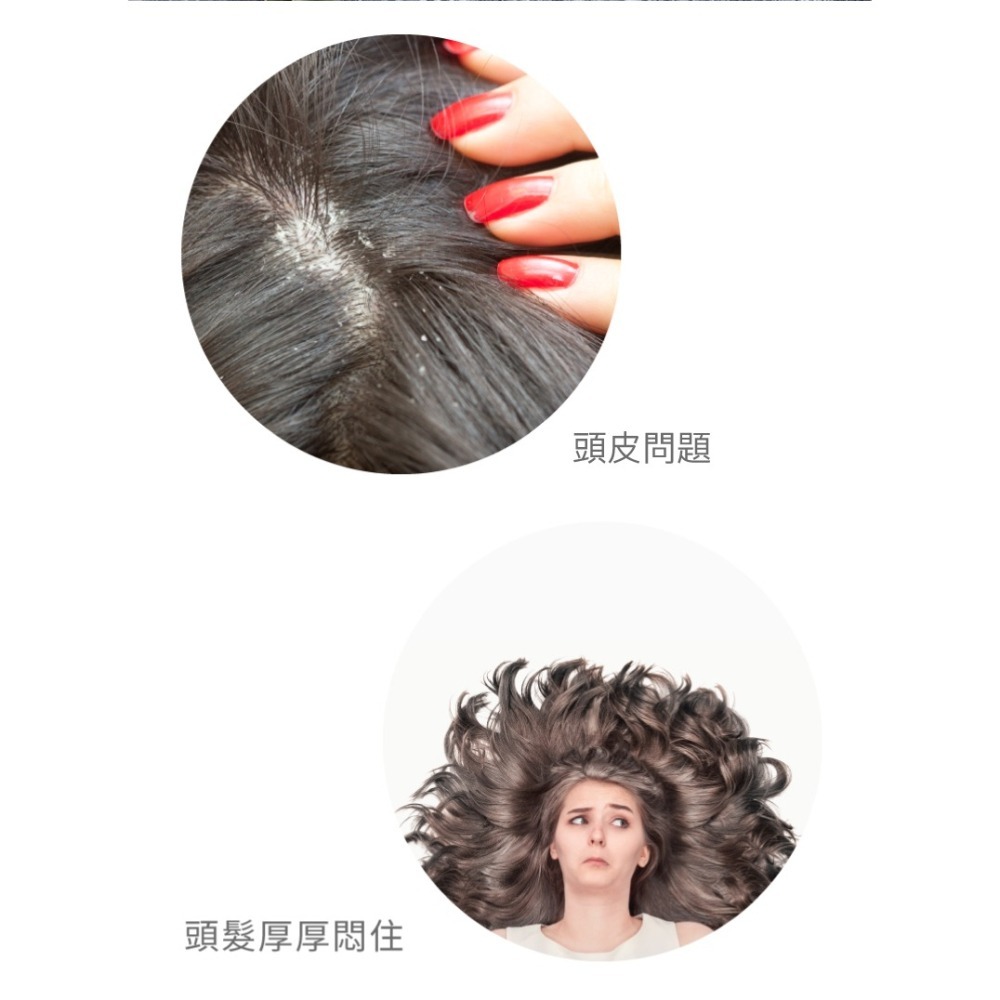 去屑微涼 茶樹4T頭皮養護噴霧100g-細節圖4