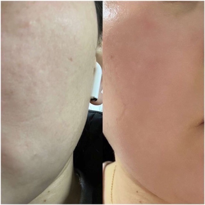 韓國CHOOSYU 抗氧抗糖全方位延緩衰老面霜50ml 面霜 全膚質-細節圖3