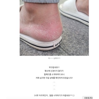 韓國Thanks Myleg 韓國製  嬰兒肌去角質保濕足跟繃帶(2入/盒)-可反覆使用-細節圖4