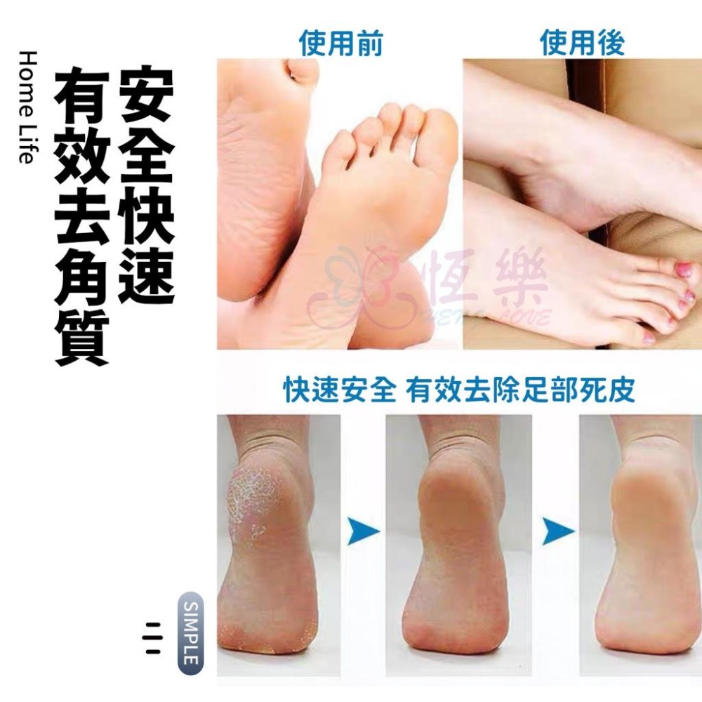 電動去腳皮機【恆樂居家】  去硬皮機 磨皮機 去角質 去死皮 美足機(Z-056)-細節圖3