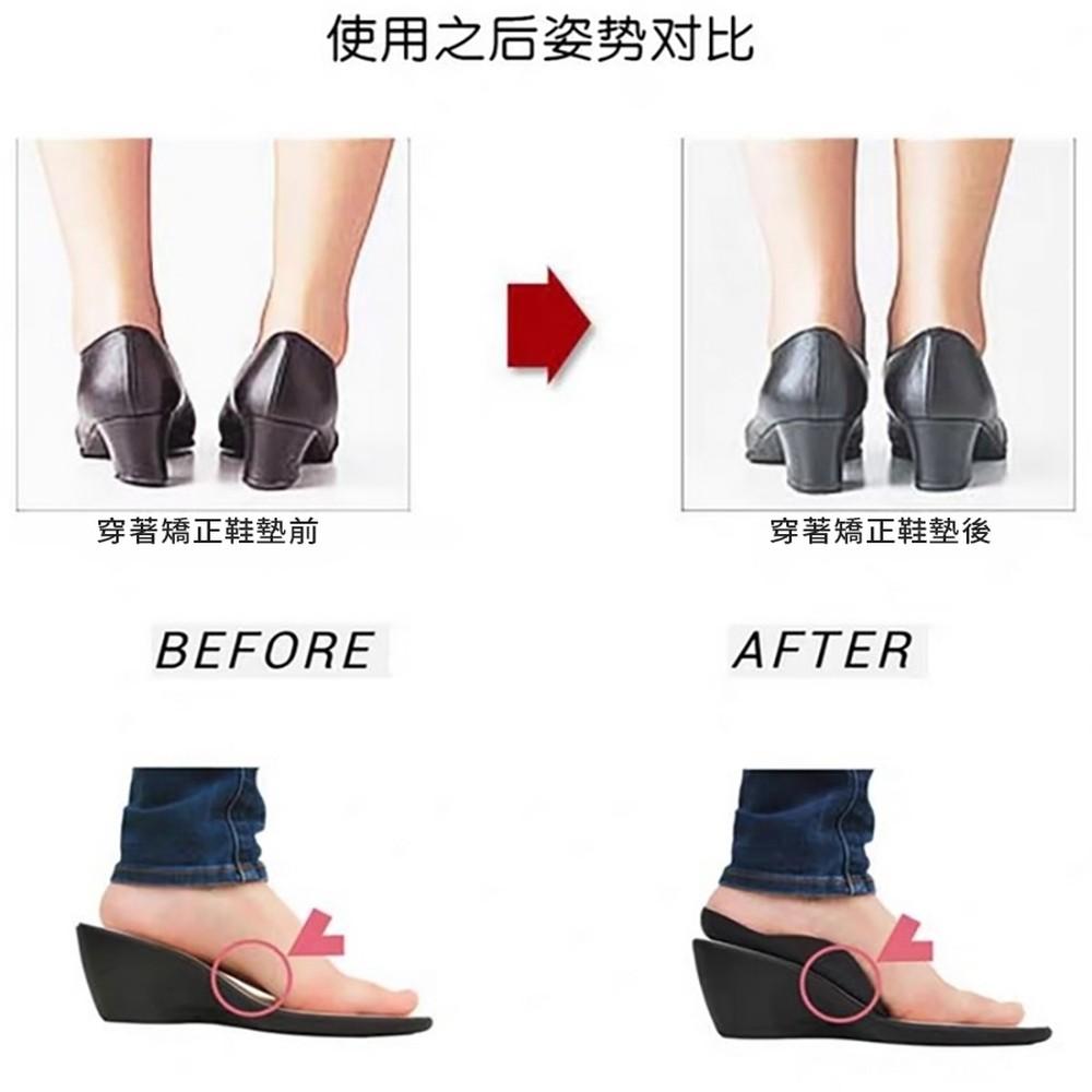 【小魚生活館台灣現貨】足弓支撐釋壓鞋墊-細節圖4