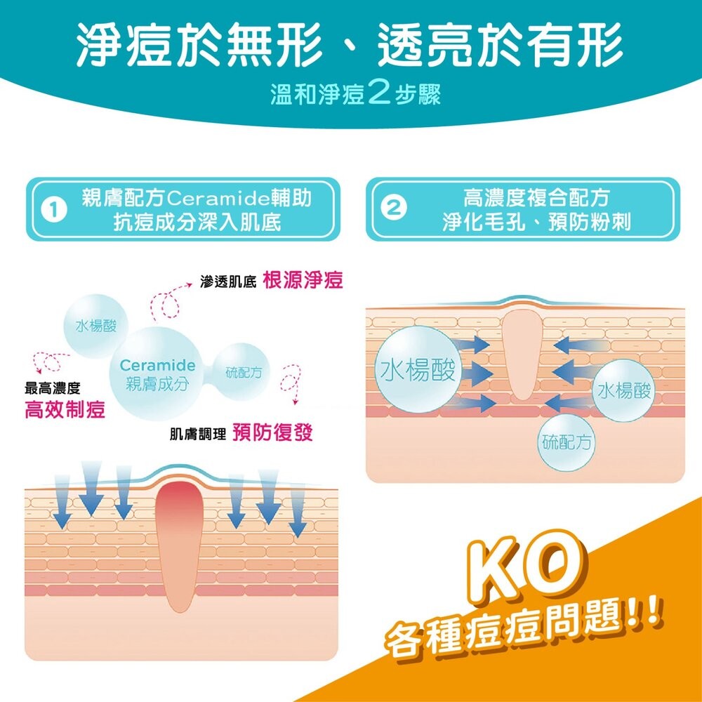 【護妍天使】煥顏淨痘 集中抗痘精華10g-細節圖6