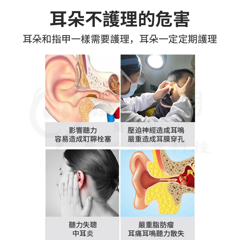 🎉專注3C🎉可視化挖耳勺 無線挖耳棒 掏耳內視鏡 3軸陀螺儀 掏耳棒 防水挖耳勺 智能防護 高清內視 WIFI連接-細節圖3