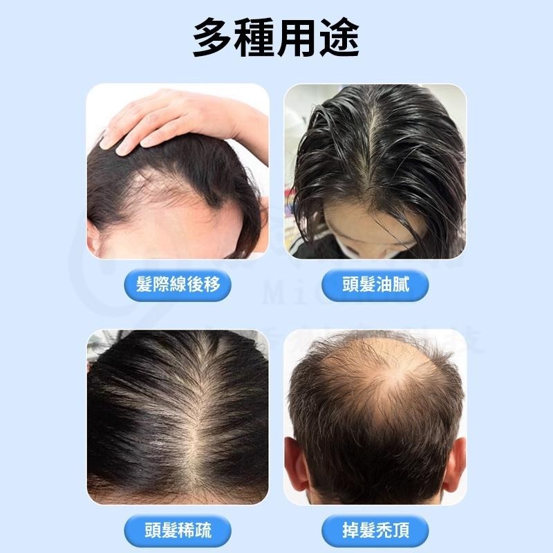 🎉新北出貨🎉140A可調節長度印章微針 圖章式家用微針 美容工具 美容用品-細節圖5