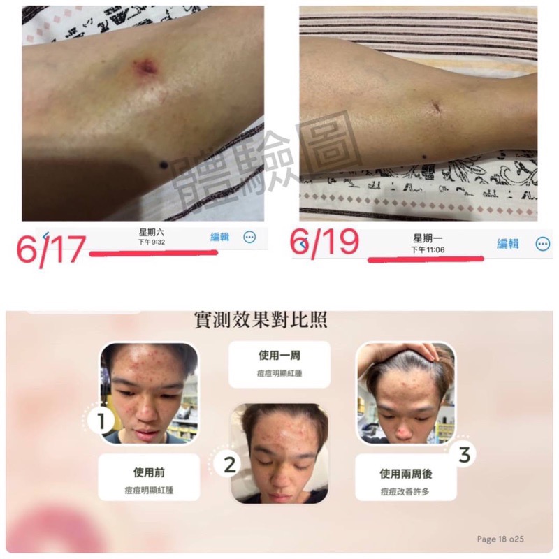 台灣SGS 植森生技 有機認證 神奇紓緩噴霧上市了❤️60ml-細節圖3