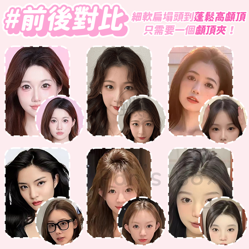顱頂夾 🪮 六齒 髮根立體蓬鬆夾 高顱頂髮夾 髮根蓬鬆夾 高顱頂神器 無痕六爪夾 髮根蓬夾 高顱頂 瀏海夾 風塑梳-細節圖6