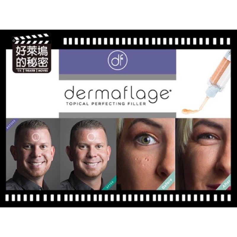 Dermaflage 疤痕隱形膠/ 臉部凹洞痘疤 臉部疤痕 特效彩妝 是填補凹洞非遮瑕膏 妝後使用/矽膠材質-細節圖3