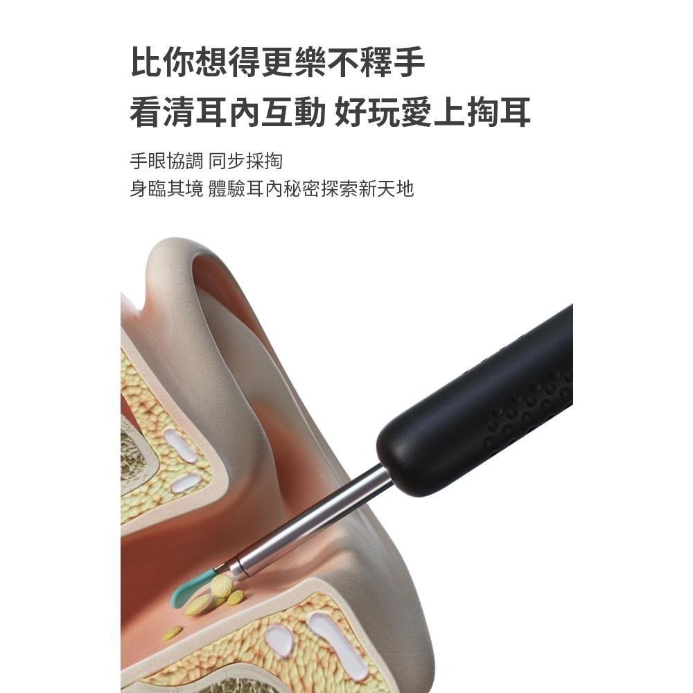 Bebird 智能可視採耳棒 R1S 台灣版 採耳棒 可視化掏耳 採耳神器-細節圖5