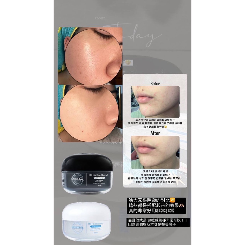 🔅現貨供應🔅B3竹炭凝膠面膜/B5保濕凝膠面膜/B12青春修復凝膠面膜500ml-細節圖4