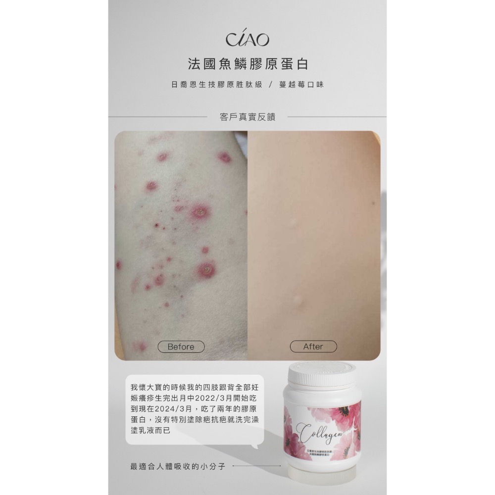 🔅現貨供應🔅Collagen 法國魚鱗胜肽級膠原蛋白200g-細節圖5