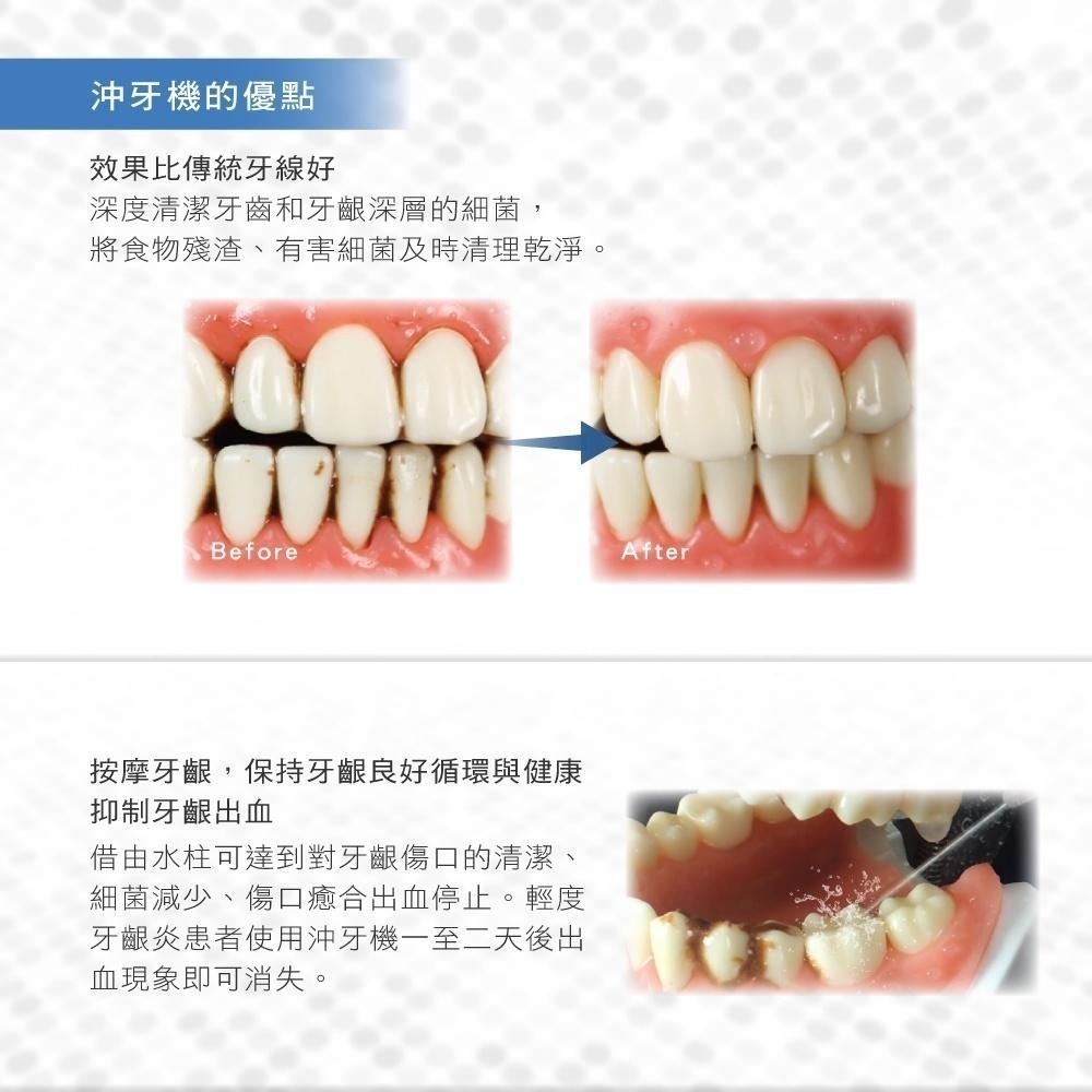 【KINYO】攜帶型家用健康沖牙機 (IR) USB 洗牙器 牙套 牙齒清潔 清潔口腔 洗牙機 無段式調整水壓-細節圖4