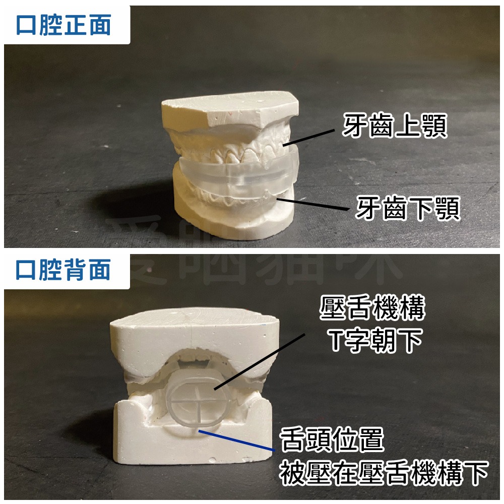 【醫療產品】健舌器 舌肌訓練 現貨 打鼾 打呼 訓練舌頭 口腔訓練 講話練習 喝水練習 舌頭訓練 說話訓練 口腔 舌頭-細節圖5