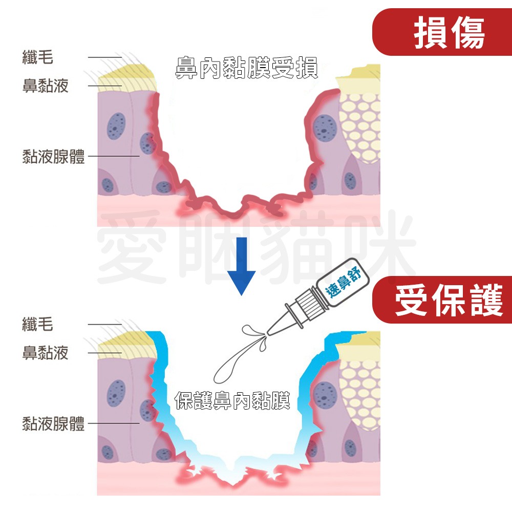 【醫療產品】速鼻舒 鼻腔傷口 鼻腔乾燥 臭鼻症（萎縮性鼻炎） 超效保濕 鼻腔保護 液體繃帶 鼻噴劑 鼻乾 鼻-細節圖4