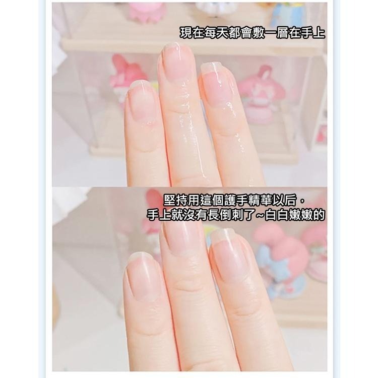 玻尿酸護手精華液 護手精華液 護手霜 護手精華 手霜 手部保濕 手部保養 手保養 滋潤護手霜 龜裂 手部 補水手霜-細節圖7