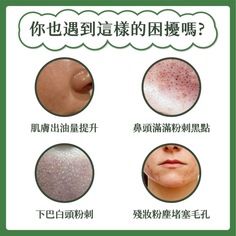 SODA BEAUTY 炭酸抗痘潔顏慕絲150ml/瓶 新包裝-細節圖2