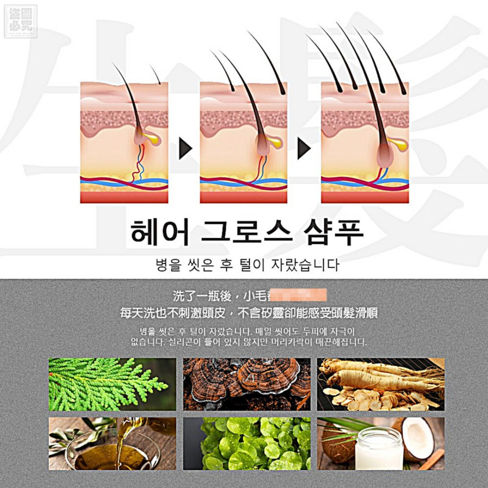 韓國育髮中心專用 外祕體洗髮精500ml 韓國中標貨-細節圖4