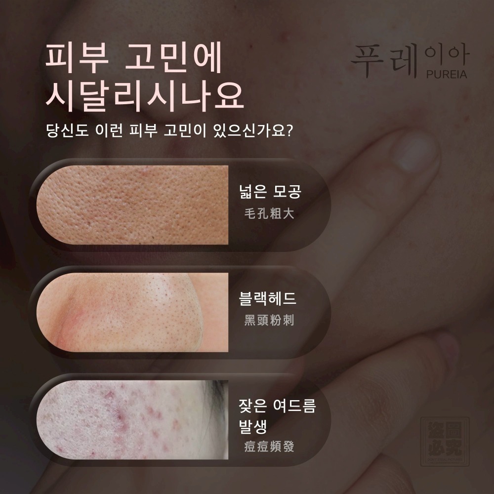 韓國Pureia 毛孔收縮控油淨痘棉片55片入/瓶 中標公司貨-細節圖2