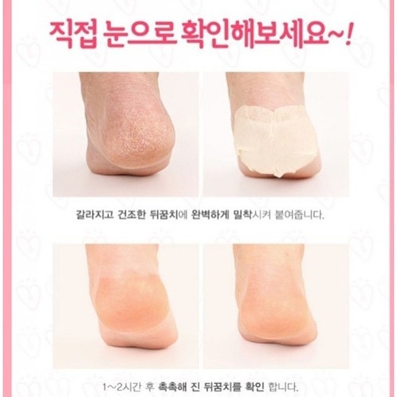 ◖魔女美妝◗ 韓國 Prreti BABY 去角質滋養後腳跟貼 去角質 足膜 足貼 足跟貼 1對-細節圖2