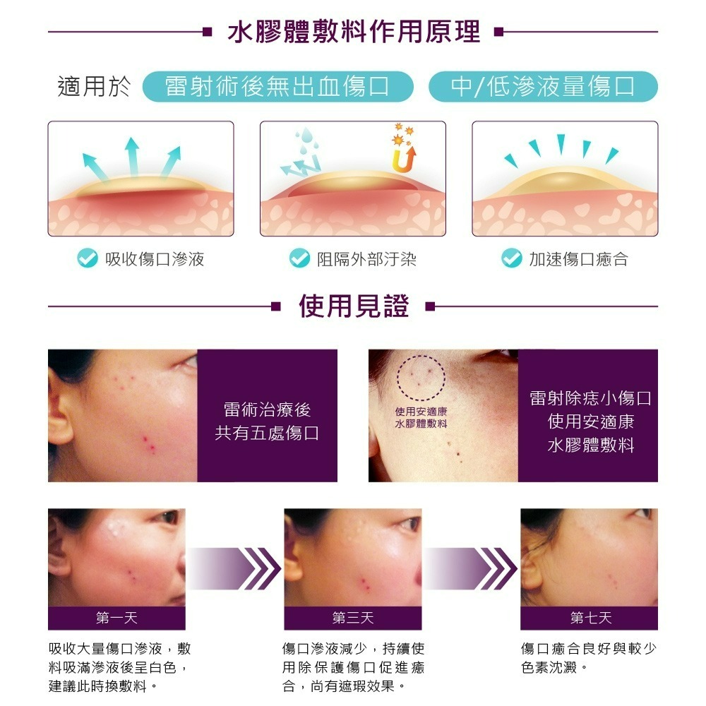 安適康痘貼36入-細節圖4