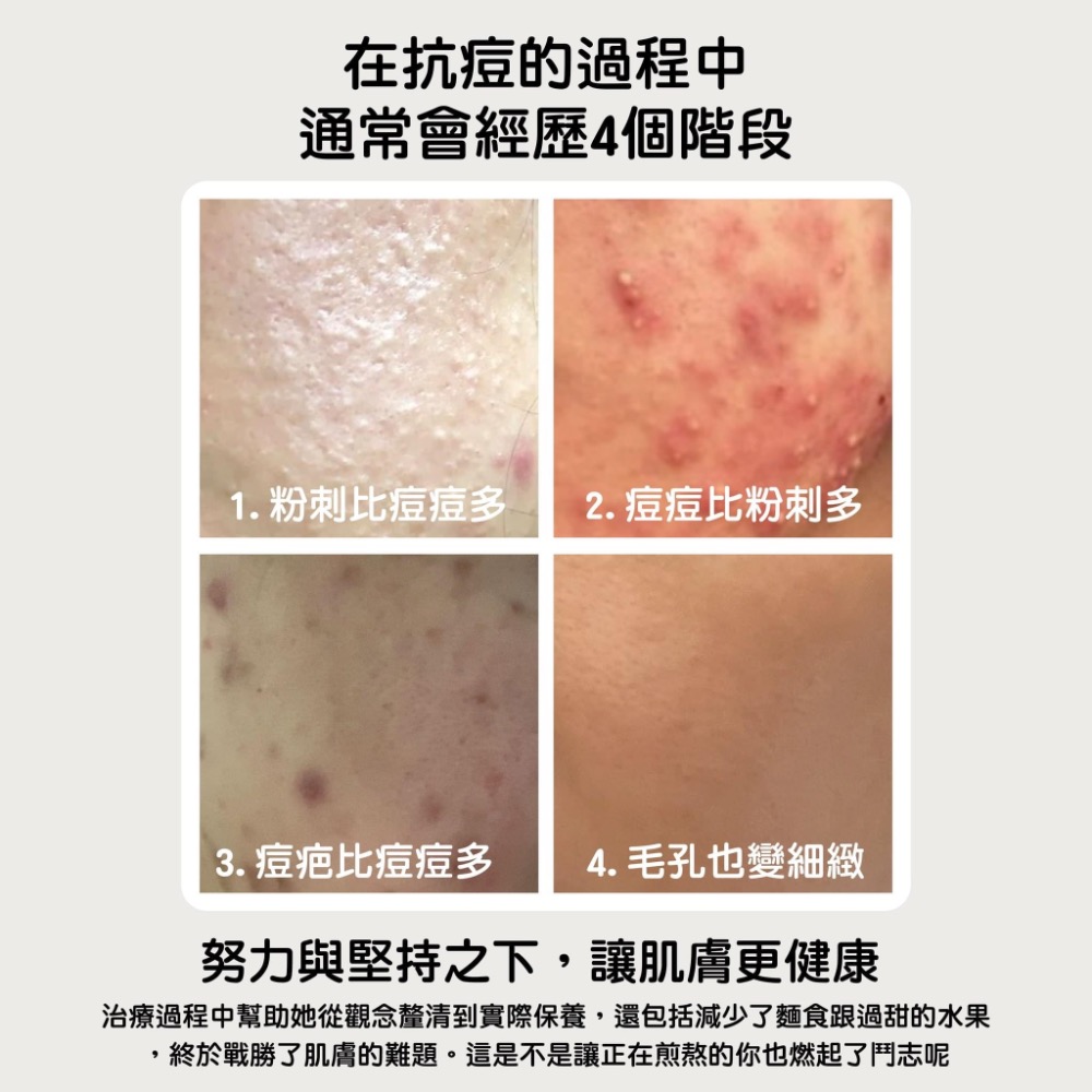 青春激活更新系列✨更新精華+更新霜-細節圖5
