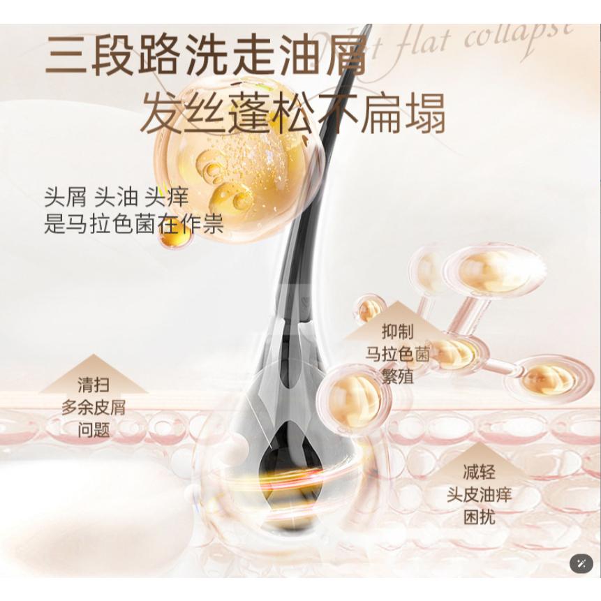 @台灣現貨~1%二硫化硒洗髮精 二硫化硒洗髮水 去屑洗髮精 去屑洗髮水 清爽止癢控油 去皮頭屑洗頭精-細節圖5