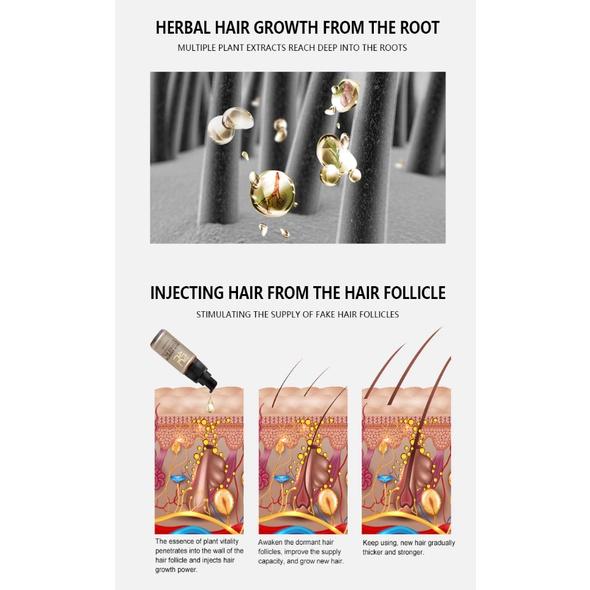 頭髮護理生姜噴霧修護幹枯斷裂毛躁 柔順蓬松光澤 生姜精華液-細節圖6