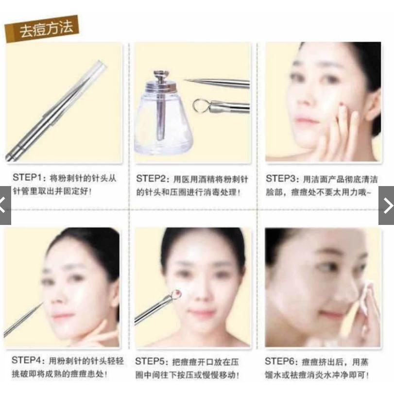 雙頭不鏽鋼粉刺針 青春棒 暗瘡针 美容針 擠痘痘工具-細節圖7