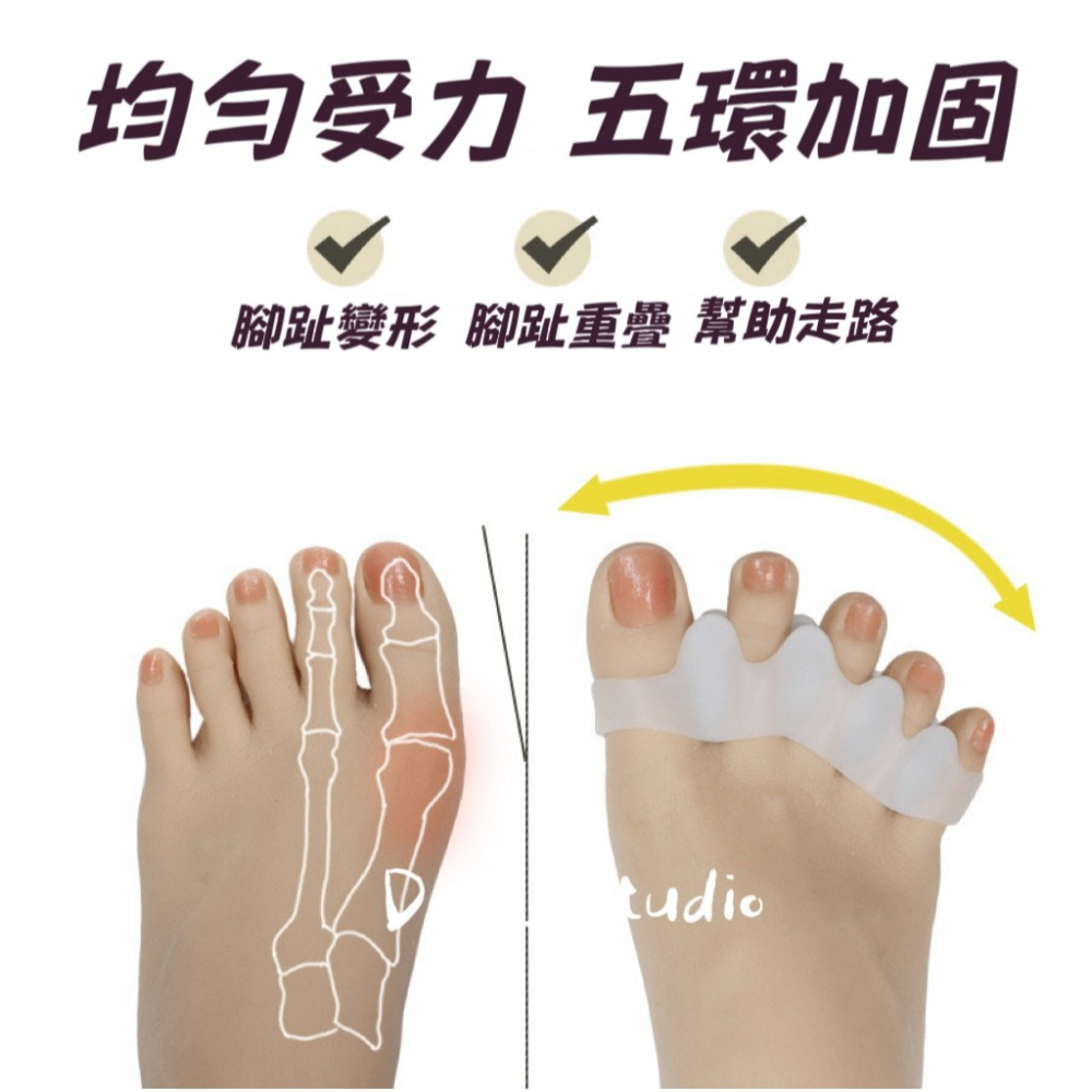 鳥我一下好嗎🍀矽膠分趾器 拇指外翻用 日夜用 腳趾重疊擠壓分離器 腳趾固定器 保護腳趾 防痛 腳指頭分離 腳趾 指頭套-細節圖7