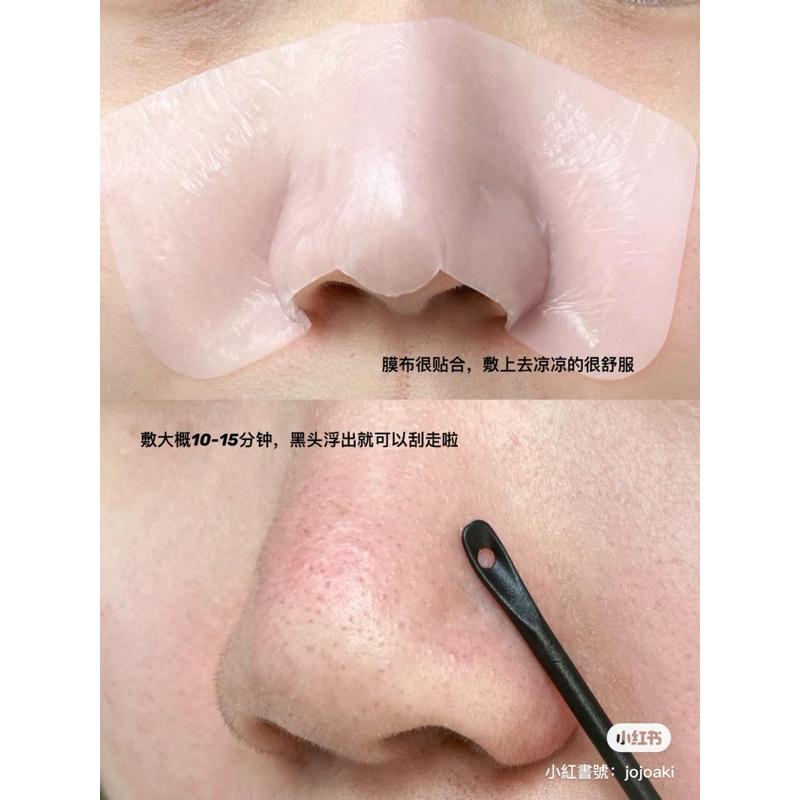 新品現貨｜𝙐𝙉𝙉𝙔 𝘾𝙇𝙐𝘽 悠宜雙效潔淨去黑頭鼻貼 😎粉刺吸塵器🤍官方授權店鋪🔥-細節圖5