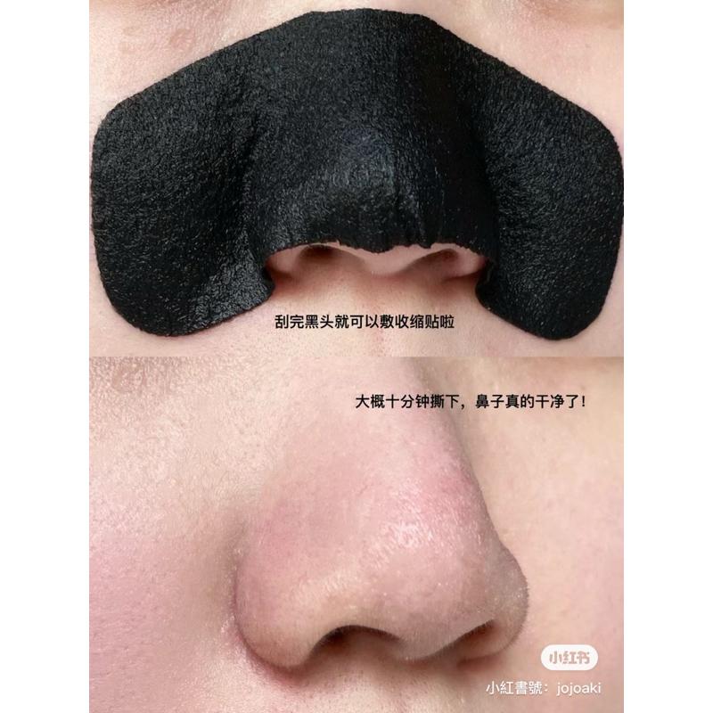 新品現貨｜𝙐𝙉𝙉𝙔 𝘾𝙇𝙐𝘽 悠宜雙效潔淨去黑頭鼻貼 😎粉刺吸塵器🤍官方授權店鋪🔥-細節圖7