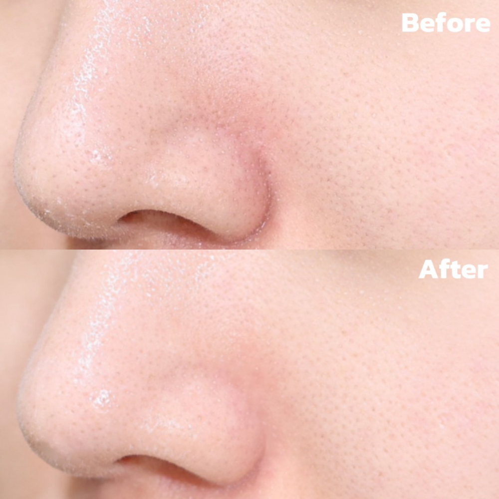 現貨-韓國 Arencia綠茶LHA深層毛孔潔面乳150ml-細節圖3