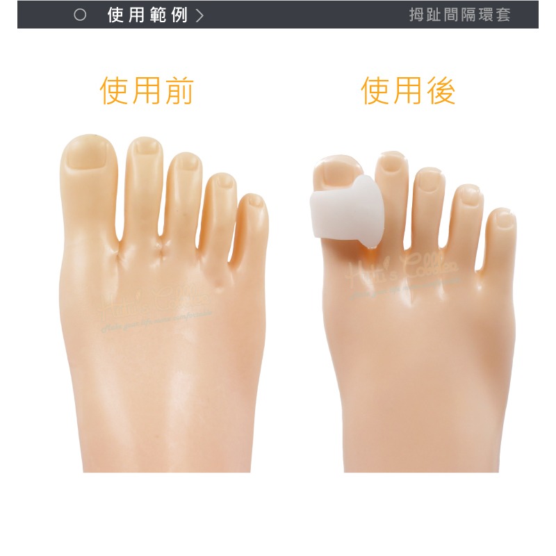 糊塗鞋匠 優質鞋材 J18 拇趾間隔環套 1雙 矽膠腳趾套 拇趾分隔器 單孔分趾器 矽膠套-細節圖8