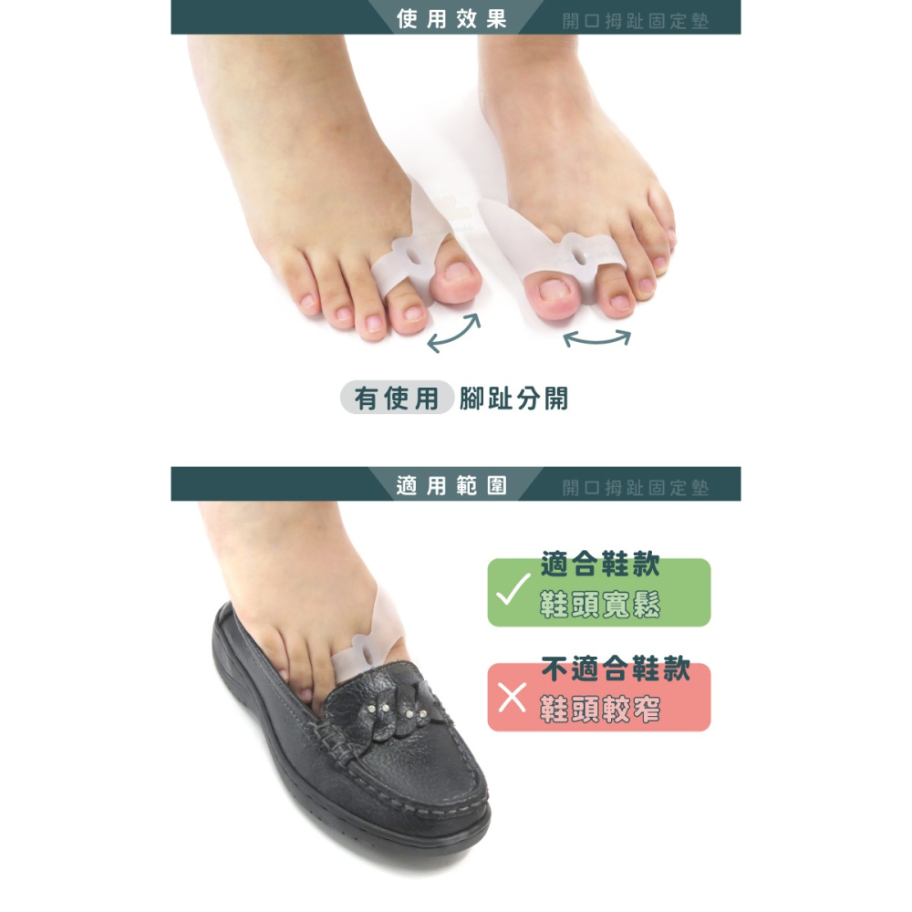 糊塗鞋匠 優質鞋材 J23 開口拇趾固定墊 1雙 拇趾分隔墊 拇趾固定套 拇趾分離墊-細節圖7