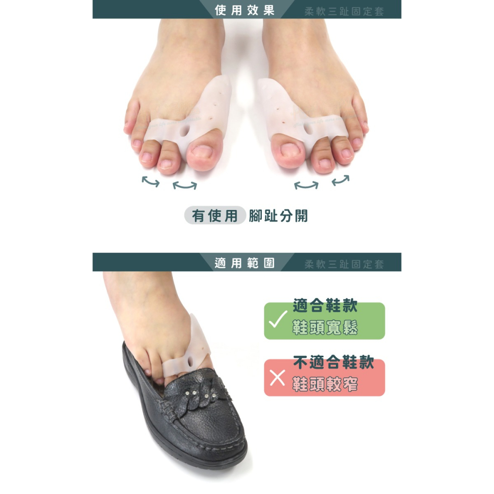 糊塗鞋匠 優質鞋材 J33 柔軟三趾固定套 1雙 拇趾分隔墊 拇趾固定套 拇趾分離墊-細節圖7