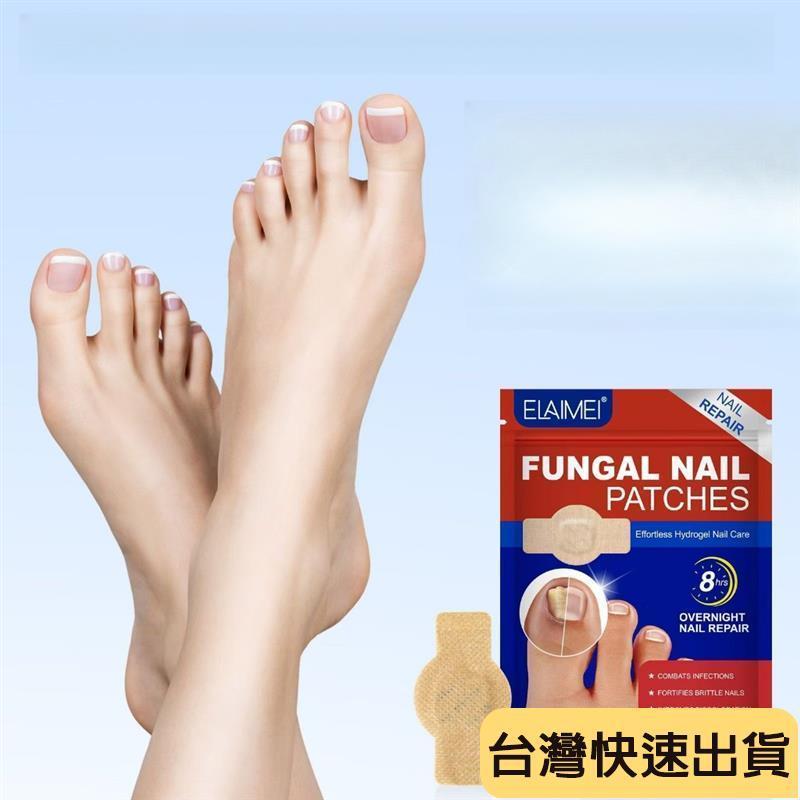 🌟麒麟優選🌟灰甲貼 指甲護理貼灰指甲指甲貼甲軟甲增厚型甲溝修護貼趾甲修護貼-細節圖2