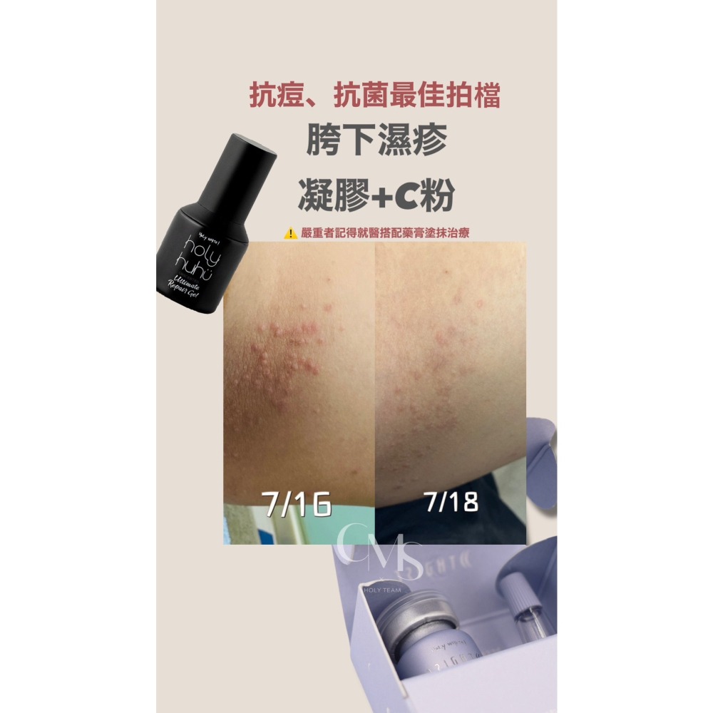 HoLy WHiTe! 超激光白皙C粉-細節圖4