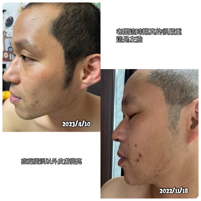 恬瀾系列雙A日夜修護凝露30/ml透亮肌膚淡化細紋原價1580-細節圖2