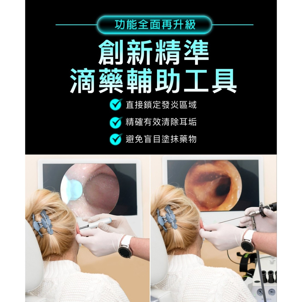 【Bebird HOME 30S】 智慧科技可彎折微型攝影掏耳棒 | 趣買購物旅遊生活館-細節圖5