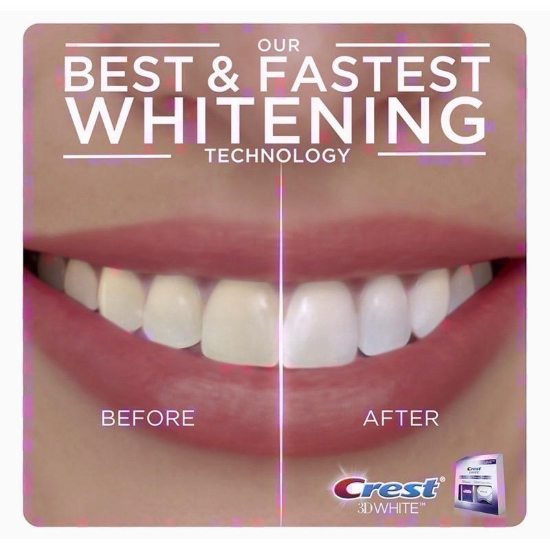🈶️優惠新包裝💓美國🇺🇸原裝 Crest 3D whitestrips藍光冷光美白儀+牙貼組-細節圖3