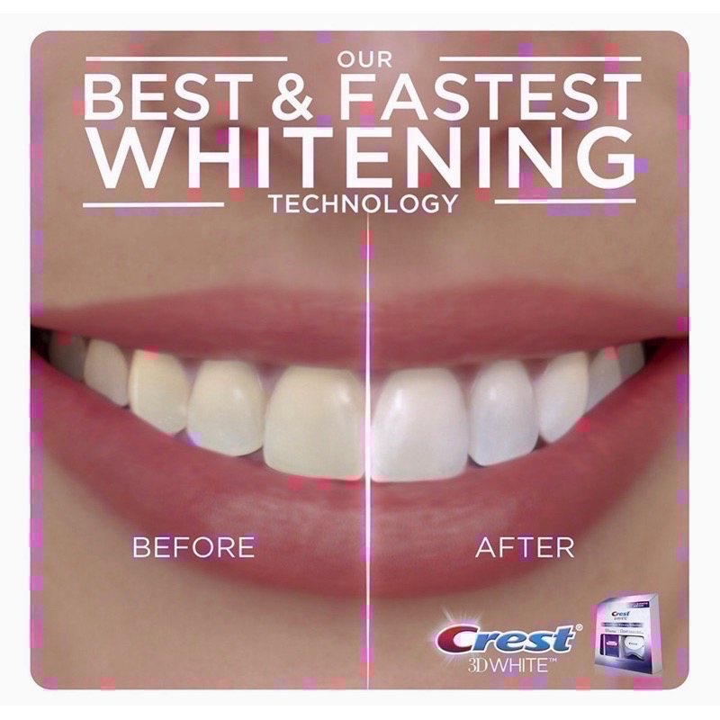 新包裝💓Dr.Grace推薦🫶美國Crest 3D whitestrips+Light藍光冷光美白儀+牙貼組-細節圖3