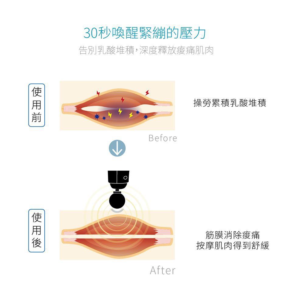 贈充電器USB供電【光速出貨】健身肌肉放鬆器震動放鬆槍深度按摩按摩筋膜槍 健身用母親節下殺🔥超輕便小巧筋摩槍肌肉按摩器-細節圖5