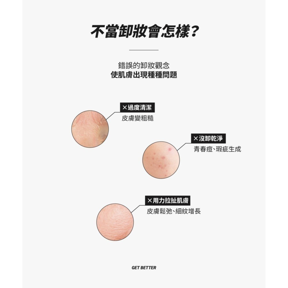 金銀花深層淨痘卸妝水｜溫和卸妝 潔淨毛孔-細節圖7