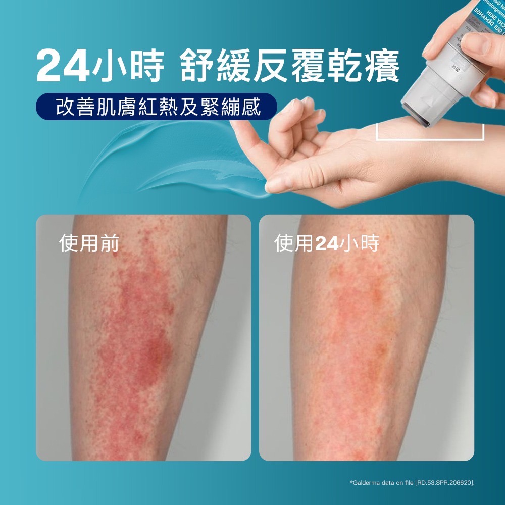 Cetaphil舒特膚 AD益膚康瞬效舒敏凝膠 59g-細節圖3