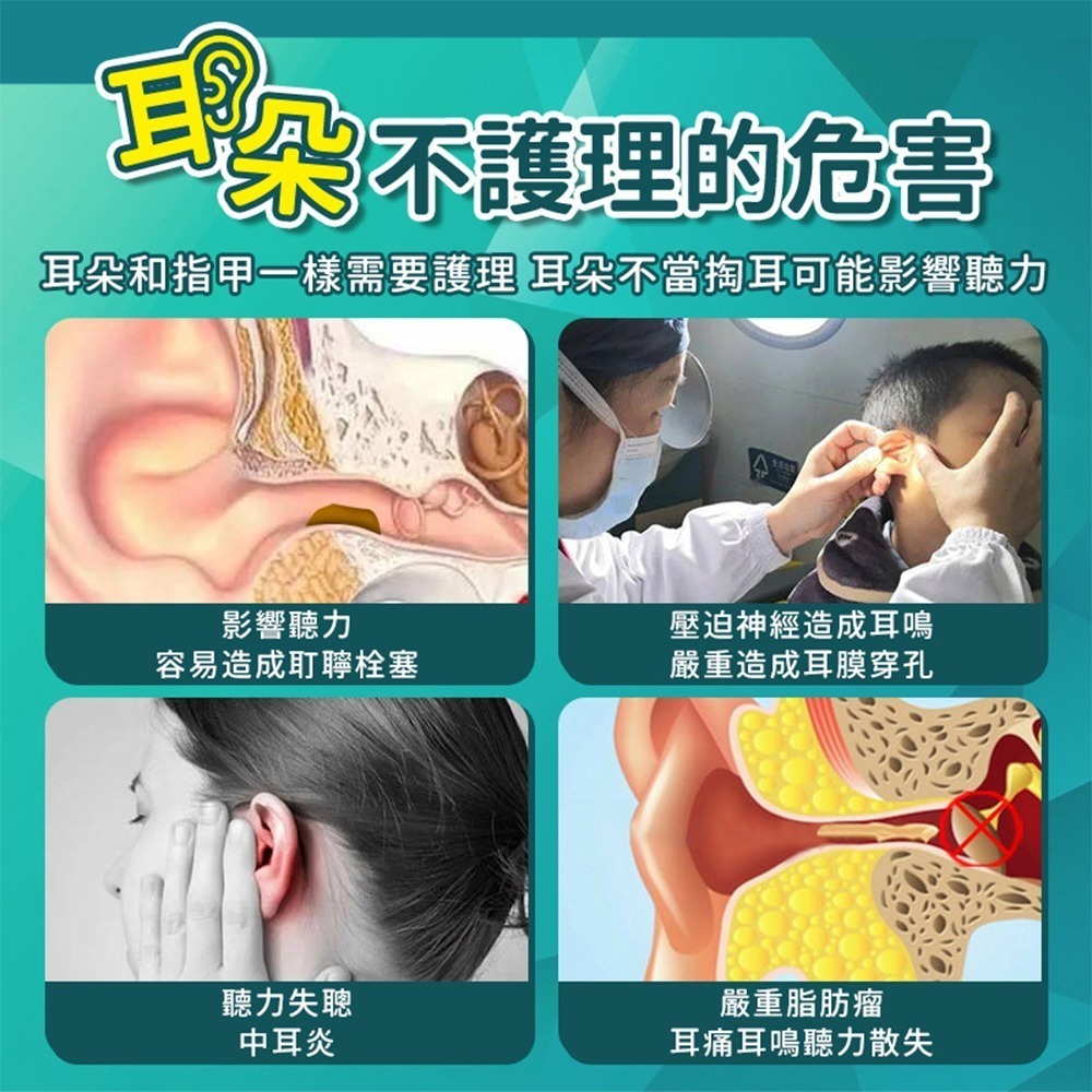 小米有品 映趣可視採耳棒 NE3 挖耳勺 內視鏡 採耳棒 掏耳棒 挖耳棒 耳部 耳朵 清潔棒-細節圖4