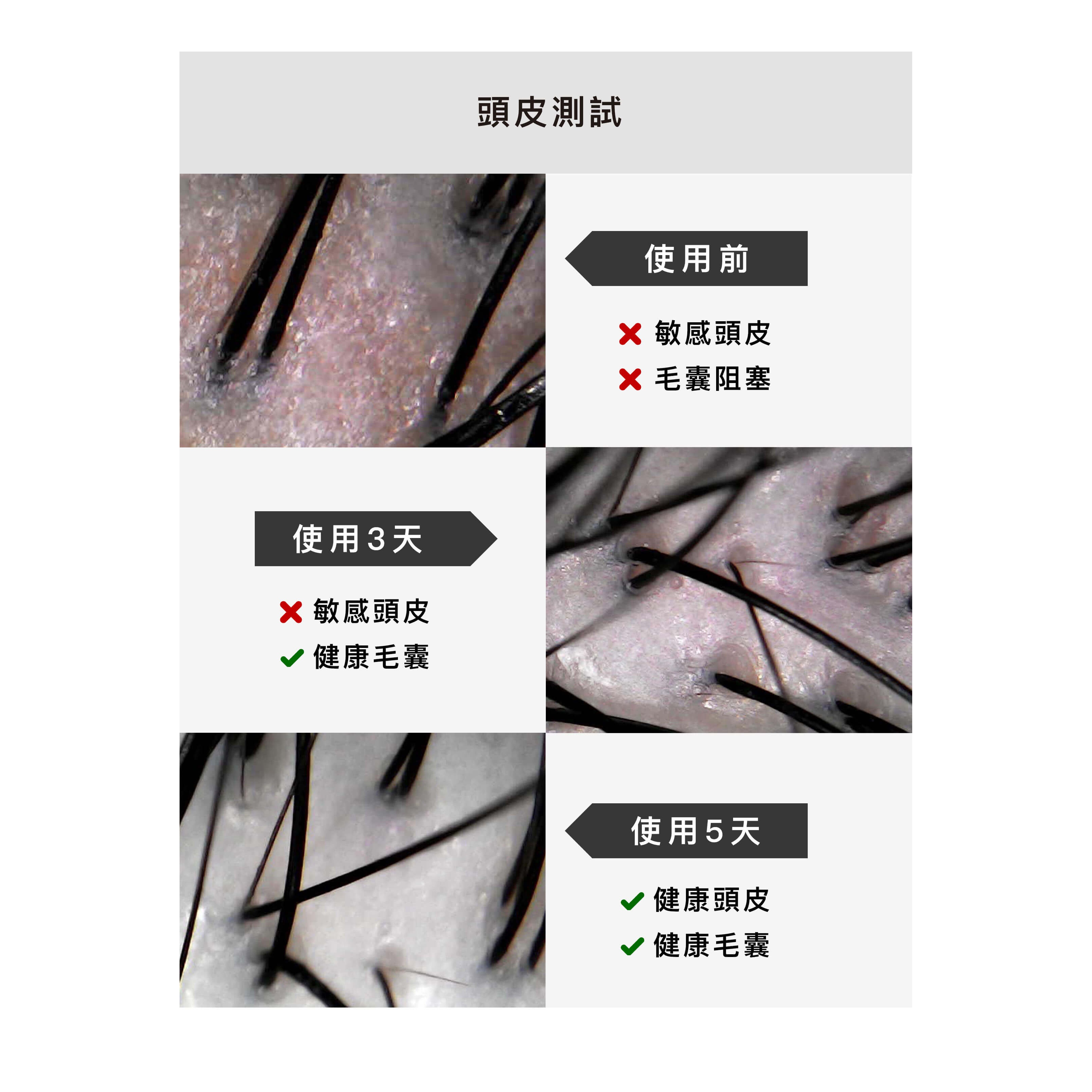 𝐂𝐈𝐀𝐎.膠原蛋白【洗髮精】止癢抗屑配方（涼感）-細節圖3