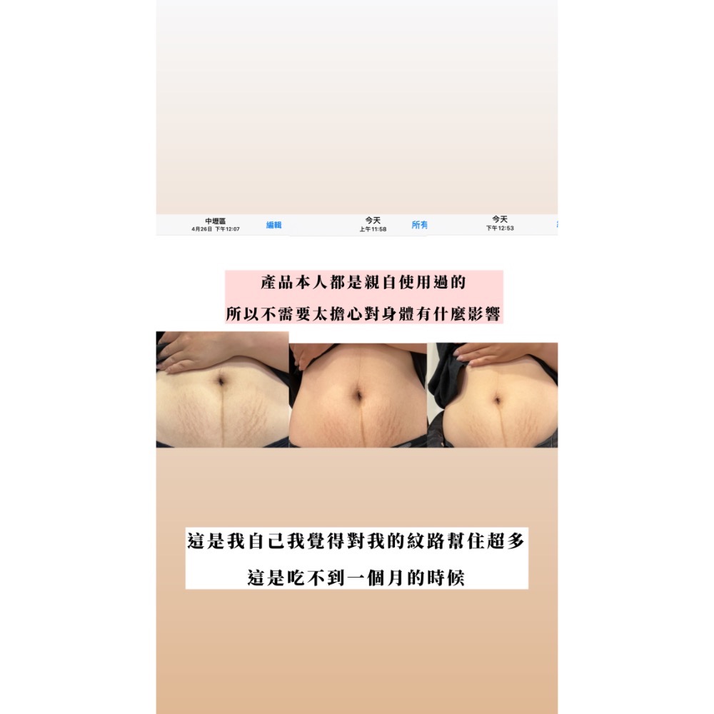 超強小粉膠原蛋白❤️出清！-細節圖8